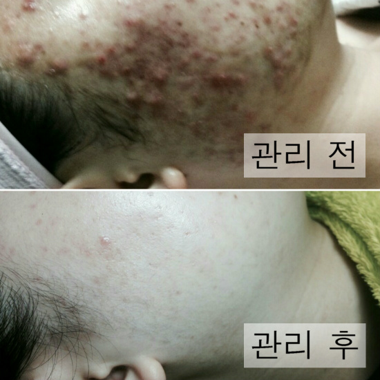 전후2.jpg
